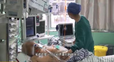 时事热点 | 一男子因空调长时间不清洗导致肺部感染进ICU，你的空调洗了吗？